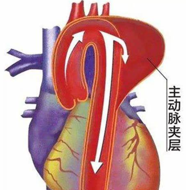 【警惕】冬季高发，男子倒地不起：“痛到像整个人被撕开！”