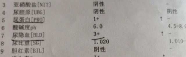 女子一家三代都有血尿,外婆、妈妈、舅舅都遭了,有这些症状要当心(图1) 66.png
