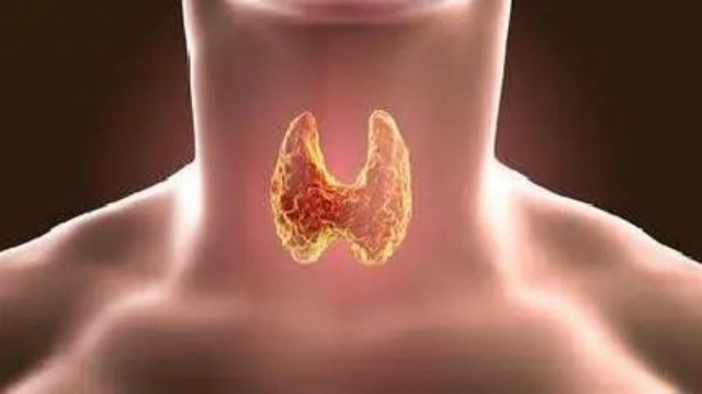 【扩散】女性高发，注意！