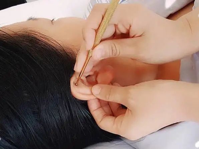 【耳穴埋豆】藏在耳朵上的减肥开关:选对穴位,减肥加倍(图2) 2.jpg