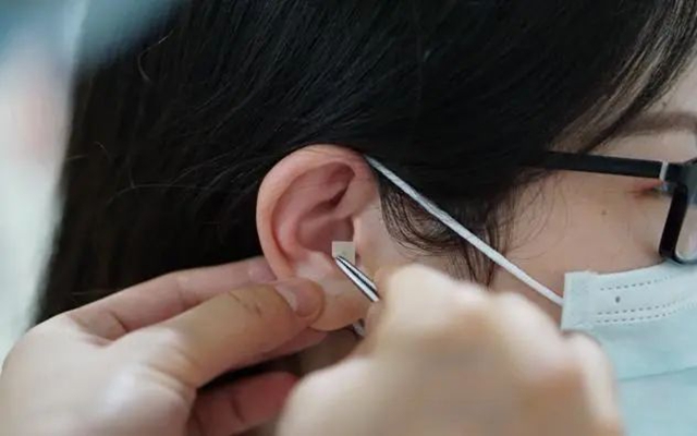 【耳穴埋豆】藏在耳朵上的减肥开关：选对穴位，减肥加倍