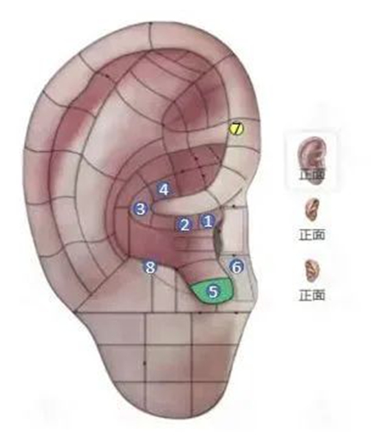 【耳穴埋豆】藏在耳朵上的减肥开关:选对穴位,减肥加倍(图6) 6.jpg