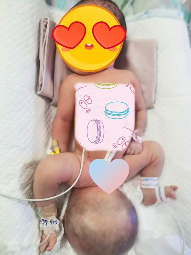 刚出生的宝宝竟然有“两个头”？真相是…… 