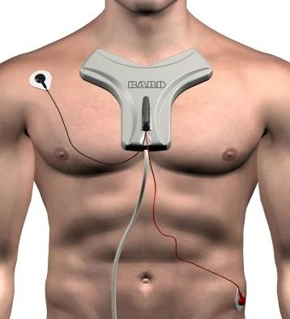 川南首例！“GPS”装进血管，静脉治疗迈入“智能精准导航”时代