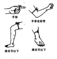 蛇出没请注意!泸州市人医储备有抗蛇毒血清,关键时刻能救命!(图6) 6.png