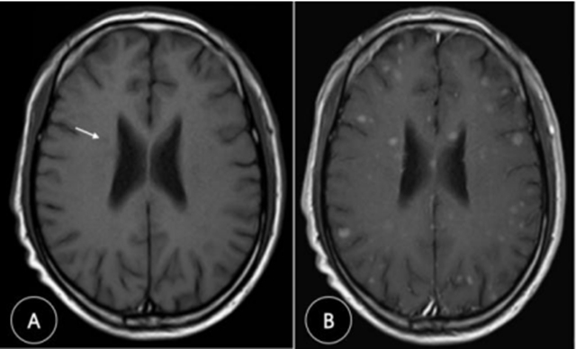 【关注】看病拍了片子看不懂？西南医大中医院“影像门诊”为您解答