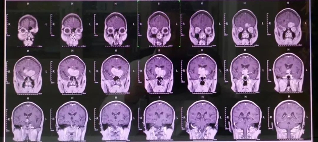 【关注】看病拍了片子看不懂?西南医大中医院“影像门诊”为您解答(图2) 片2.jpg