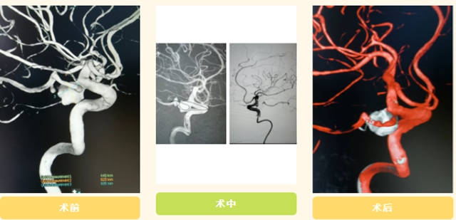 太有才了!患者家属把藏头诗写进锦旗,里面竟有医生的名字(图3) 6403.jpg