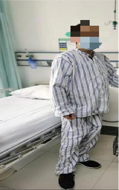 【1000余例蛇咬伤】泸州男子用嘴吸蛇毒,夫妻俩人差点……(图7) 7.jpg