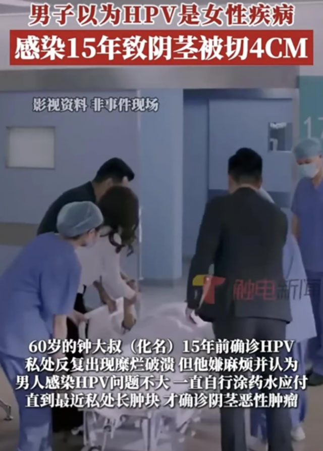 【围观】男子感染HPV拖15年,“命根子”被切4公分!(图1) 1.jpg