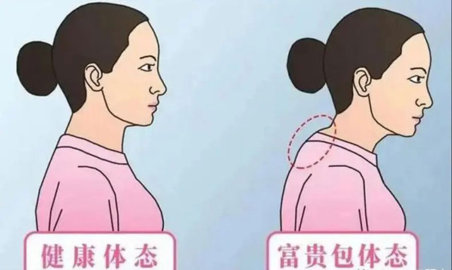 【关注】脖子上打2个小孔,轻松治愈大包!(图1) 1.jpg