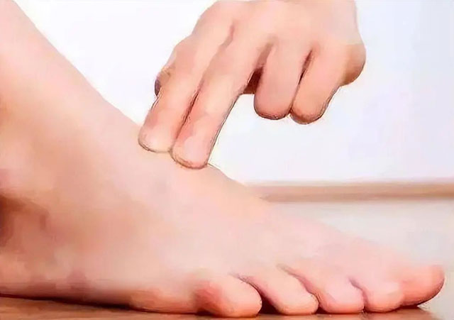 【警惕】一旦出现这些情况……就只能截肢?(图5) 6.jpg