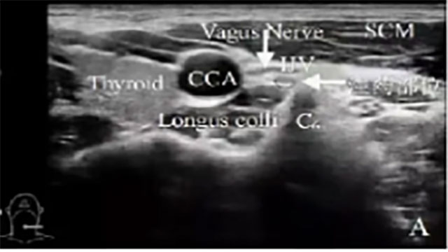 合江县中医医院睡眠科开科 | 中西医协同,专治“睡不着、睡不好”!(图7) 7.jpg