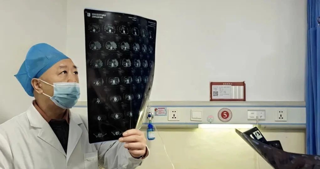 肺癌术后52天,头部长出3颗肿瘤(图2) 2.jpg