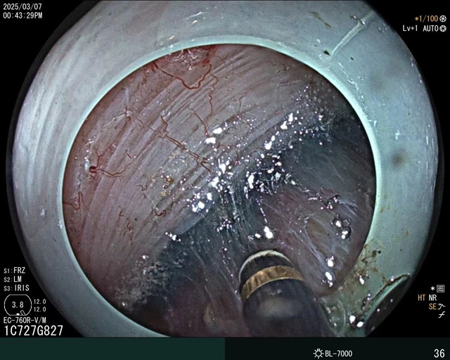 肛肠科两名见多识广的帅哥医生来了(图3) 3.jpg