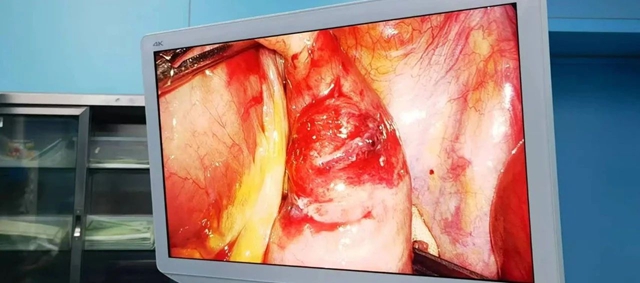 肛肠科两名见多识广的帅哥医生来了(图6) 7.jpg