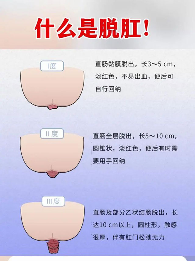 高中生上厕所,肠子“掉”了出来……(图3) 3.jpg