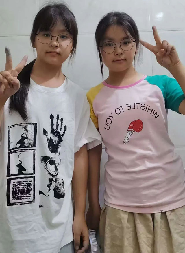 用爱心浇灌的两对连体“姐妹花”,长大后选择“医”路追随~(图14) 14.jpg