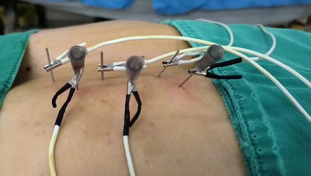 Double kill!女子被“蛇”缠上了脸(图2) 2.jpg