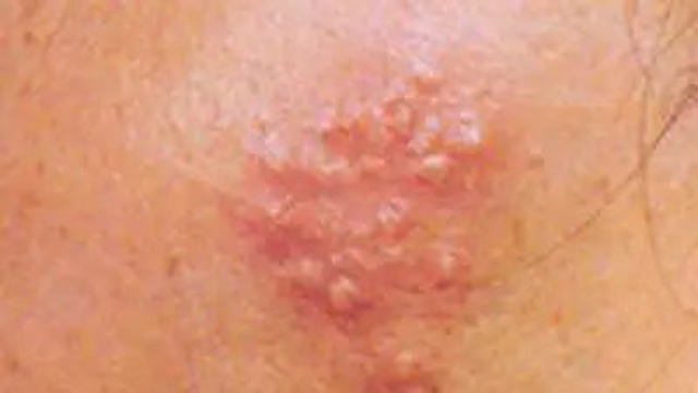 Double kill!女子被“蛇”缠上了脸(图1) 1.jpg