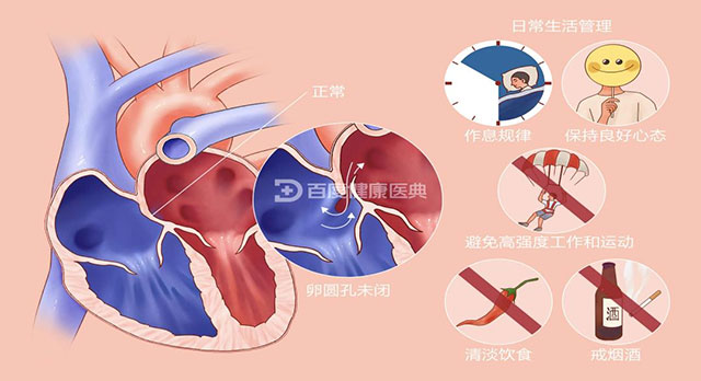 【警惕】12岁男孩脑梗死,原因竟是……(图5) 5.jpg