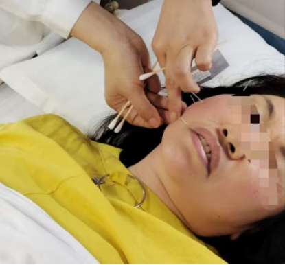 刷牙时突然口眼歪斜？35岁女士瞬间崩溃