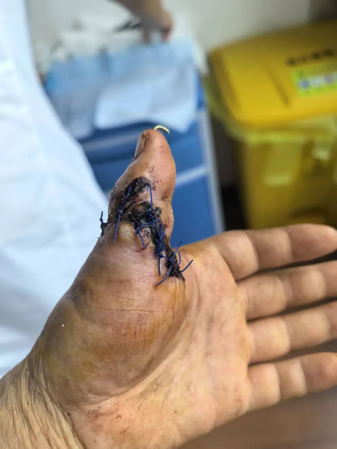 点赞!男子从非洲到泸州,帅哥医生们成功接骨(图2) 非洲2.jpg