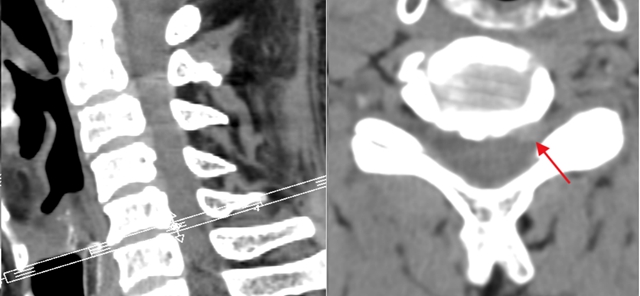 男子手麻!竟是这儿出问题(图1) 麻1.jpg