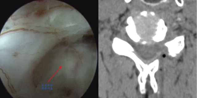 男子手麻!竟是这儿出问题(图2) 麻2.jpg