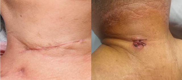 男子手麻!竟是这儿出问题(图3) 麻3.jpg