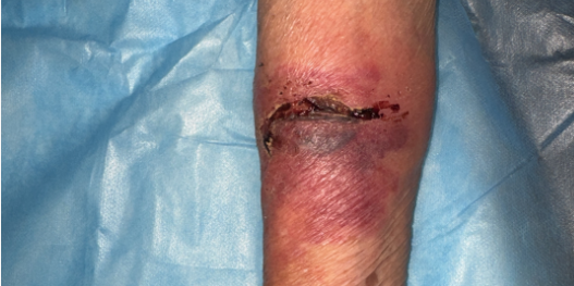 5次上门,泸州嬢嬢朋友圈怒赞(图3) 3.png