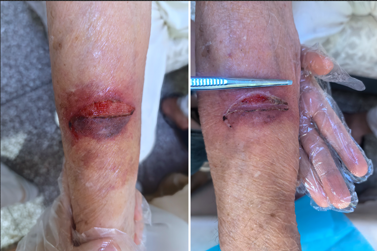 5次上门,泸州嬢嬢朋友圈怒赞(图4) 4.png