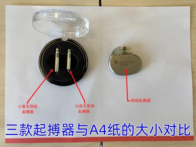 八旬老人心脏竟被“钉入”智能螺丝,这究竟是何操作?(图2) 2.jpg
