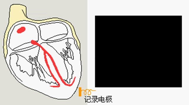 感冒也会致命?从就诊到抢救仅10分钟(图2) 2.jpg