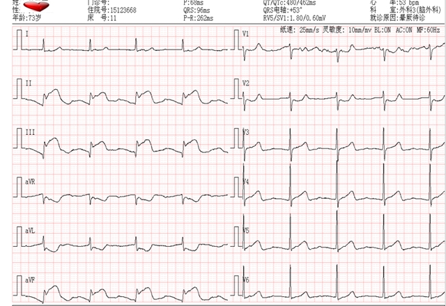 感冒也会致命?从就诊到抢救仅10分钟(图4) 4.jpg
