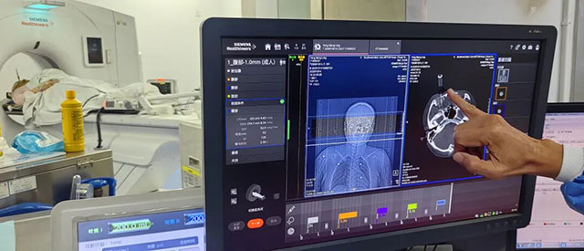 泸州16岁少女!眼眶后长出恶性肿瘤(图7) 7.jpg