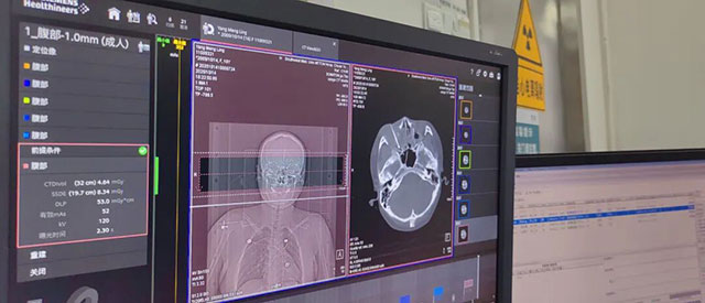 泸州16岁少女!眼眶后长出恶性肿瘤(图9) 9.jpg