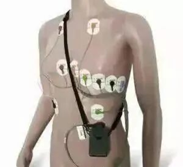 医生反复让做心电图的原因!别嫌麻烦,这5个原因关乎心脏安危(图2) 心2.jpg