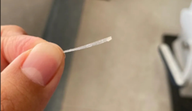 男子误吞5cm鱼刺，用土方致身亡……