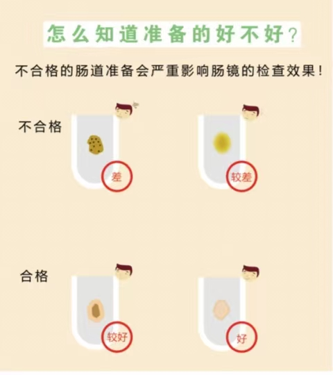 【科普】告别 “谈镜色变”:胃肠镜术前准备+术后注意事项指南(图5) 查5.png