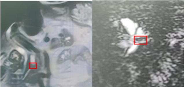 无缘无故瘦了10斤,这种腹痛千万别忍……(图1) 痛1.jpg