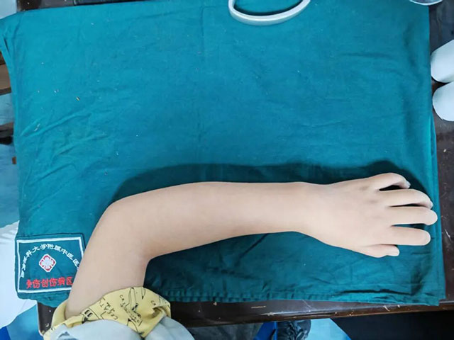 西安——泸州，9岁女孩千里求医