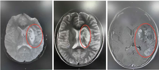 一天抢救15名患者,这些情况要警惕......(图8) 8.jpg