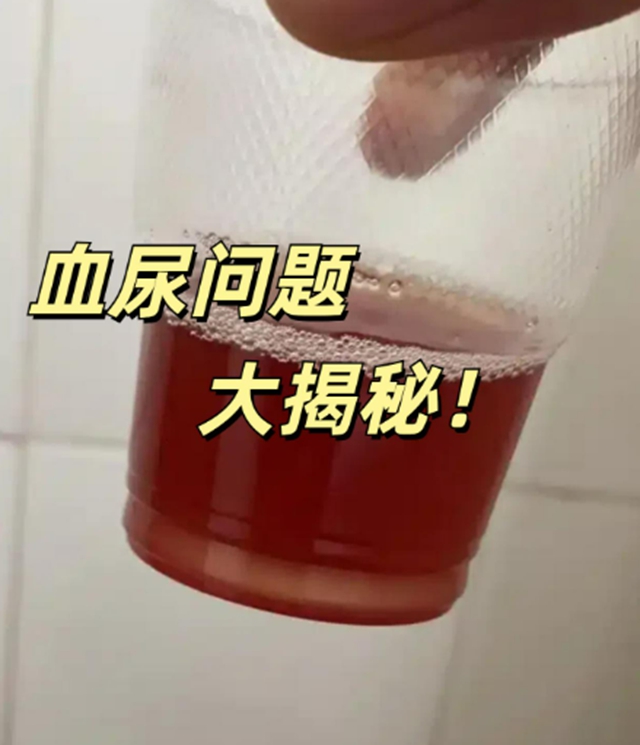 血3.jpg