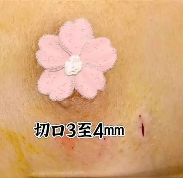 口1.jpg