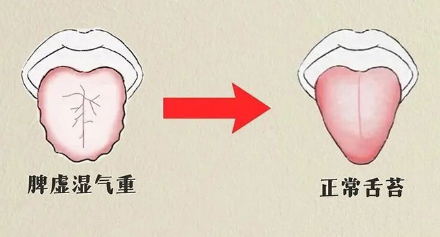 惊!夏天浑身不得劲儿,可能不是懒,是身体“进水”了!(图7) 7.jpg