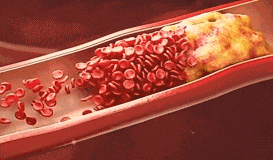 5.gif