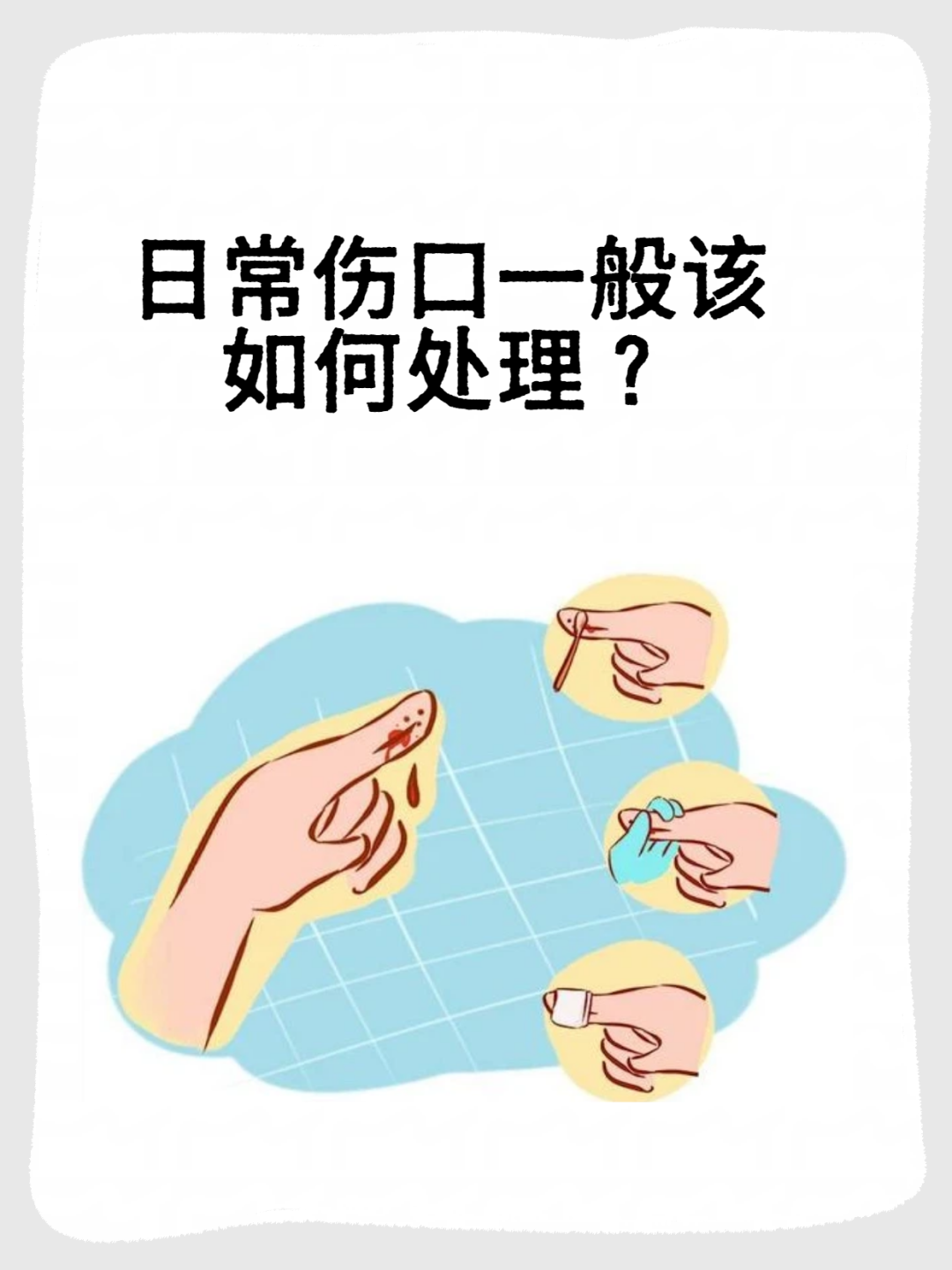 伤1.png