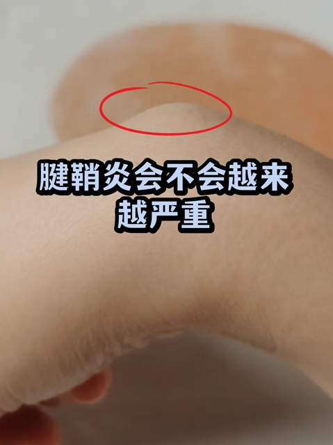 手腕手指疼痛、弹响、掰不直,还……(图3) 手3.jpg