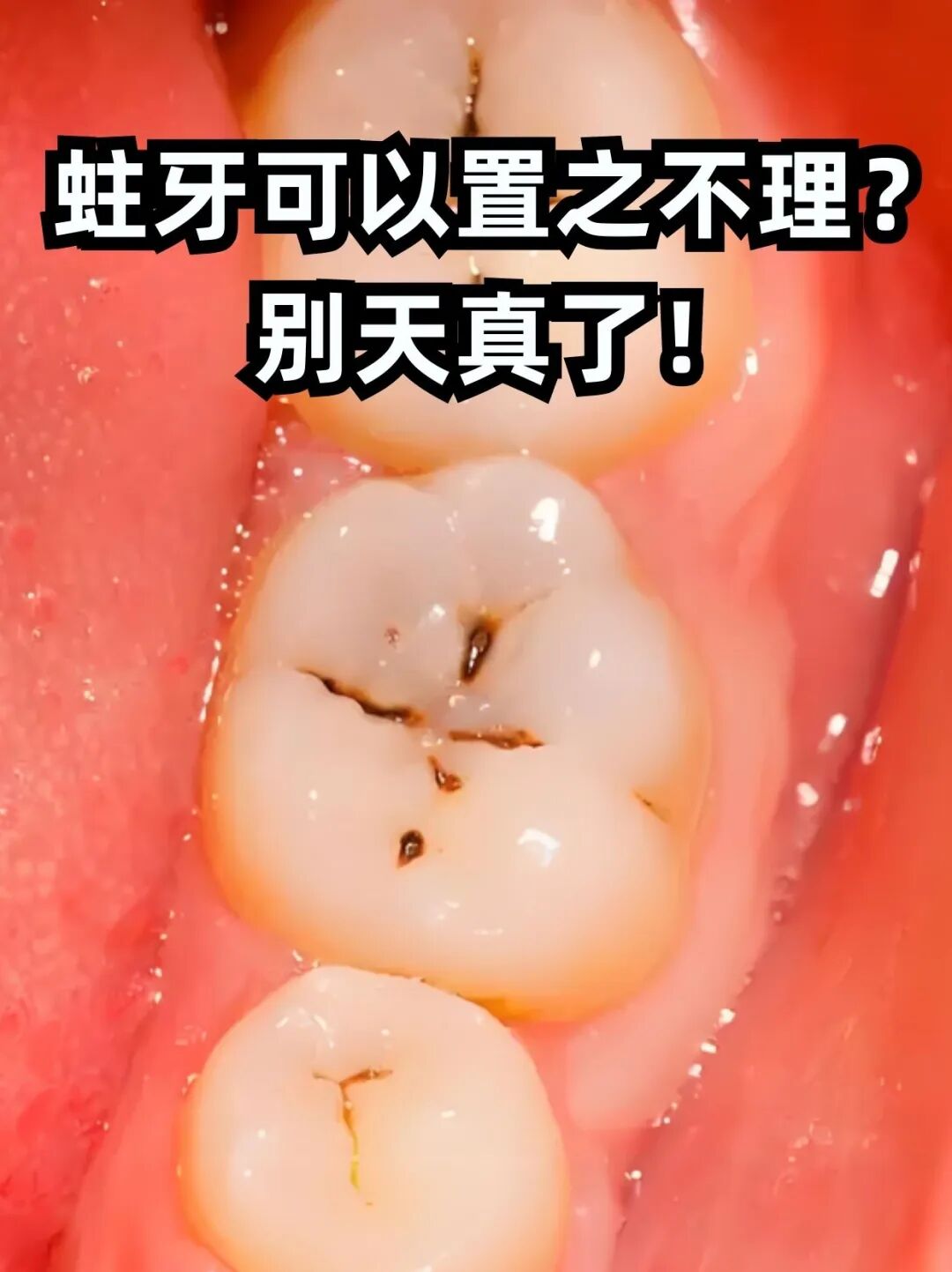 牙1.jpg